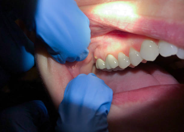 Best Emergency Dental Services Near Me  in Burlington, OH