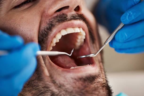Best Knocked-Out Tooth Emergency  in Burlington, OH